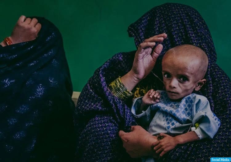 فقر در افغانستانی