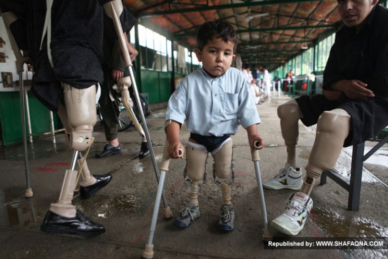 15 درصد مردم افغانستانی دارای معلولیت هستند